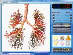 diagnostika diacom vyšetrenie v Brezne